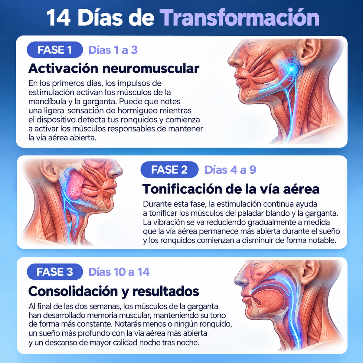 Collar Antirronquidos Inteligente