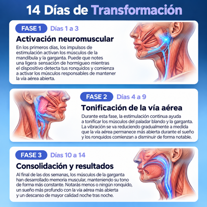 Collar Antirronquidos Inteligente
